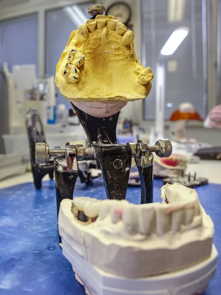 Dental Lab Articulator with dental prosthesis.  Dental casting gypsum model human Jaws in prosthetic laboratory. Dentistry, Orthodontics.