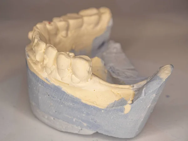 暗い背景に人間の下歯の石膏キャストのモデル — ストック写真