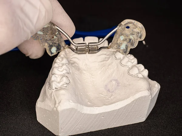 上颌骨鼓胀器 设置测试 可移动的牙齿矫正器 使上颌骨更宽 常用于治疗儿童狭窄的下颚 — 图库照片