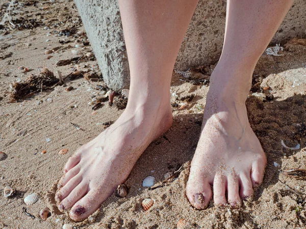 Mulheres Pés Nus Uma Praia Areia Seixo Contra Mar Dia — Fotografia de Stock