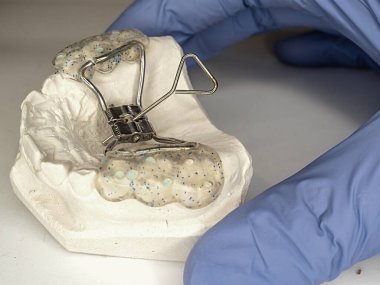 Doktor test hyrax diş modeline diş teli takıyor. Şeritli Hyrax açıcı hızlı damar genişletici. Parantez ile alçı taşı dişlerini kontrol ediyorum