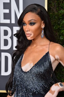Los Angeles, Usa. Winnie Harlow, Beverly Hilton Oteli 'ndeki 2020 Altın Küre Ödülleri' ne geliyor.