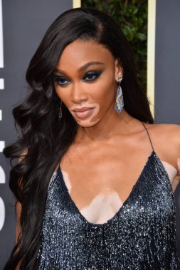 Los Angeles, Usa. Winnie Harlow, Beverly Hilton Oteli 'ndeki 2020 Altın Küre Ödülleri' ne geliyor.