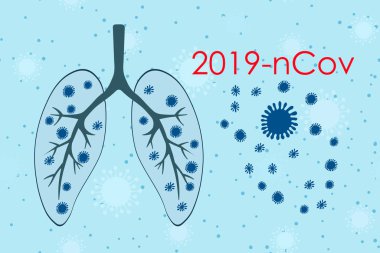 Tıbbi genetik bakteriyolojik mikroorganizma geçmişi. Wuhan Çin Coronavirüs 2019-ncov. Zatürree. Bakteri Biyolojisi Organizmaları. Virüs enfeksiyonu salgını. Sağlık geçmişi. Hasta ciğerler..