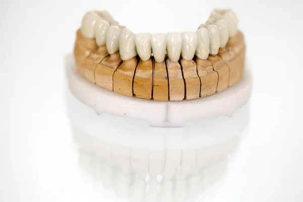 牙医存储区中的锆瓷齿板 — 图库照片