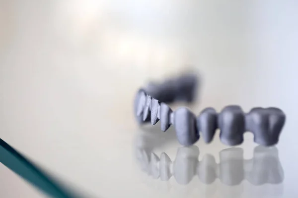 Assiette en porcelaine de zirconium en magasin dentiste — Photo