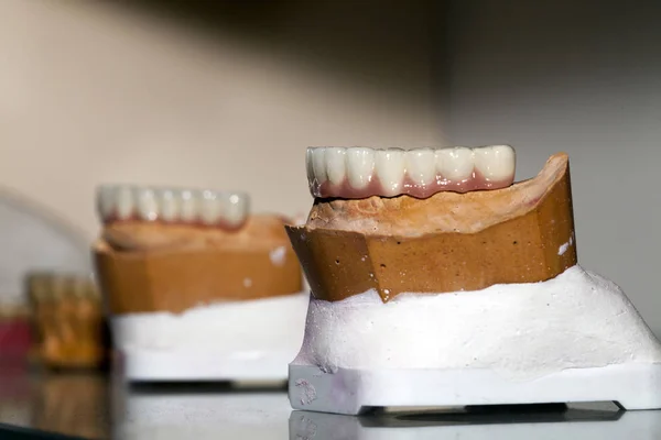 Zirkonyum porselen diş plaka dişçi mağaza — Stok fotoğraf