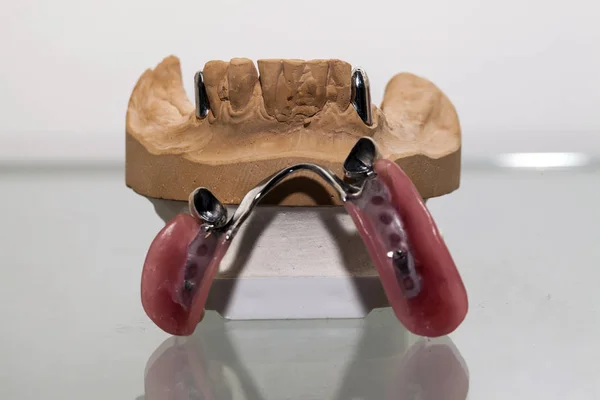 Zirconium Porcelain Tooth plate in Dentist Store — Stock Photo, Image