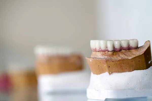 Цирконій порцеляни зуба пластини в магазині стоматолог — стокове фото