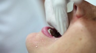 Genç kız dişçi ağız porselen bakım