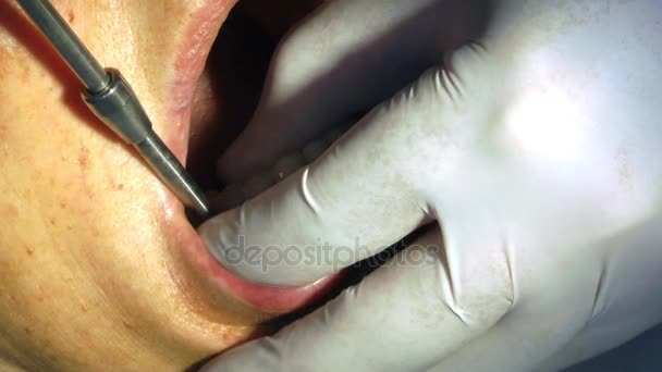 Genç kız dişçi ağız porselen bakım — Stok video