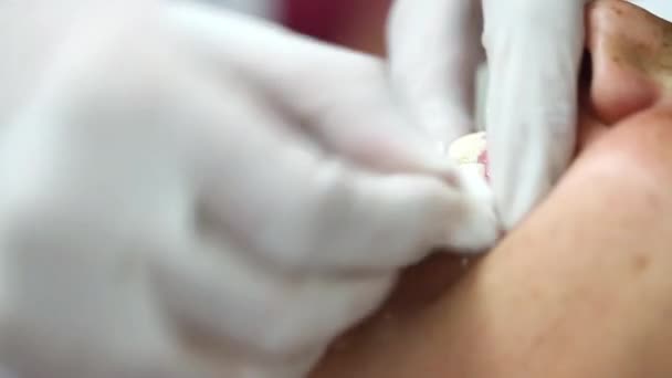 Jeune fille dans la bouche du dentiste Soins de porcelaine — Video