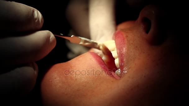 Jeune fille dans la bouche du dentiste Soins de porcelaine — Video