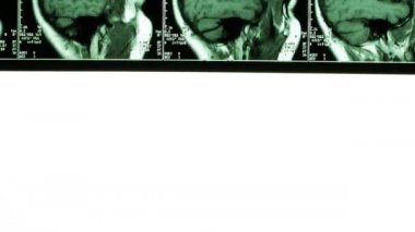 X-ışını iskelet anatomi görünümü