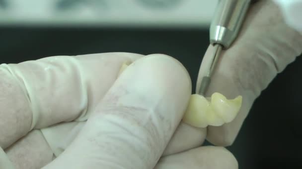 Zahnlabor Gibt Zirkonium Porzellan Zahn Arbeit Form — Stockvideo
