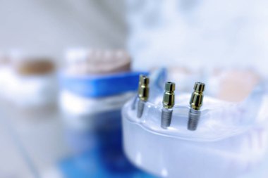 Diş diş porselen protez diş hekimi