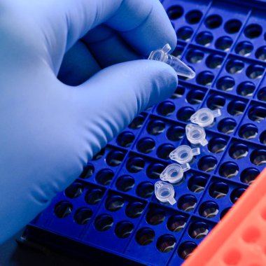 Biyobilim laboratuvarında bir DNA tüpünü bir PCR (polimeraz zincir reaksiyonu) termosiklet makinesine yüklemek. Bilim kavramı, laboratuvar ve hastalıklar üzerine çalışma.