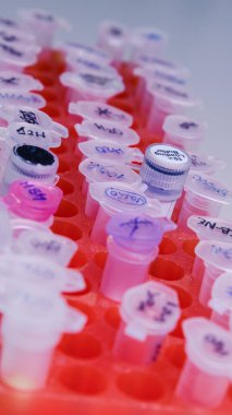 DNA incelemesi için plastik tüplü laboratuvar rafı. DNA jeli yükleme. Bilim kavramı, laboratuvar ve hastalıklar üzerine çalışma.