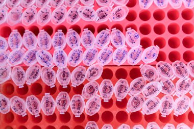 DNA incelemesi için plastik tüplü laboratuvar rafı. DNA jeli yükleme. Bilim kavramı, laboratuvar ve hastalıklar üzerine çalışma.