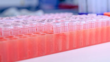 DNA incelemesi için plastik tüplü laboratuvar rafı. DNA jeli yükleme. Bilim kavramı, laboratuvar ve hastalıklar üzerine çalışma.