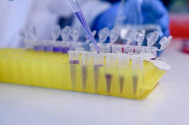 DNA araştırmaları için plastik tüplerde pipet ve matarayla çalışan bir bilim adamı. Bilim kavramı, laboratuvar ve hastalıklar üzerine çalışma.