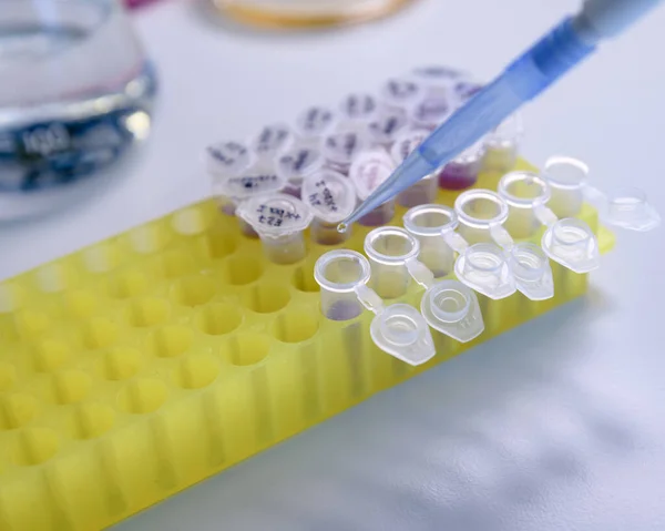 DNA incelemesi için plastik tüpler üzerinde sıvı bulunan yakın çekim pipeti. Bilim kavramı, laboratuvar ve hastalıklar üzerine çalışma.