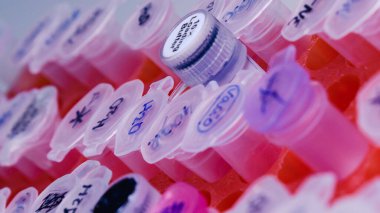 DNA incelemesi için plastik tüplü laboratuvar rafı. DNA jeli yükleme. Bilim kavramı, laboratuvar ve hastalıklar üzerine çalışma. Coronavirus (COVID-19) tedavisi geliştiriliyor.