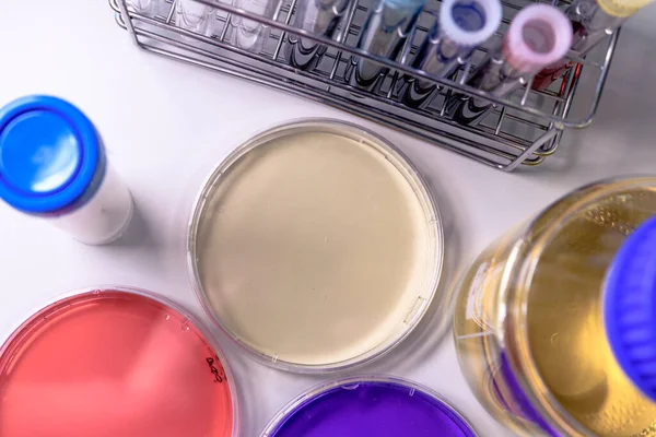Petrischaaltjes Reageerbuisjes Laboratoriumapparatuur Met Kleurstoffen Concept Van Wetenschap Laboratorium Studie — Stockfoto
