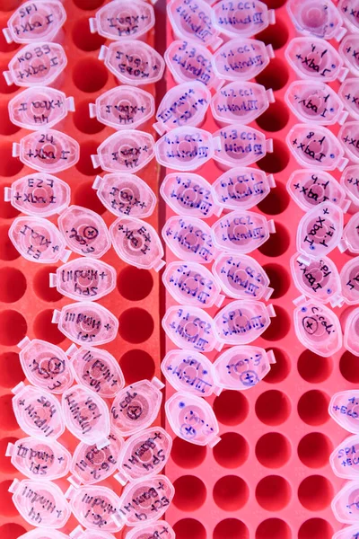 Laboratory rack with plastic tubes for DNA study. DNA gel-loading. Concept of science, laboratory and study of diseases. Coronavirus (COVID-19) treatment developing.