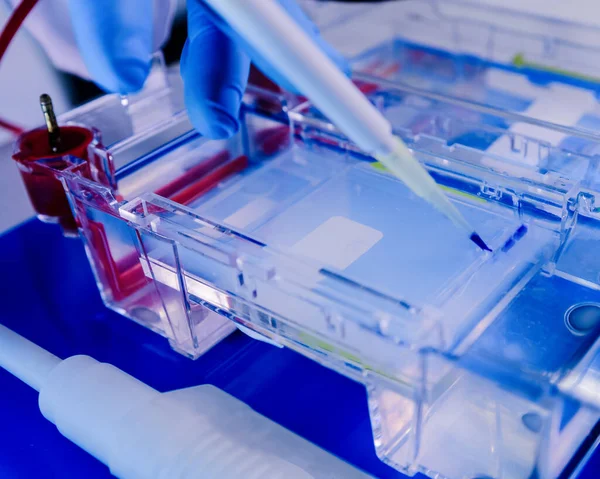 Elektroforez odasındaki jellerde protein ayrışması. Bilim kavramı, laboratuvar ve hastalıklar üzerine çalışma. Coronavirus (COVID-19) tedavisi geliştiriliyor.