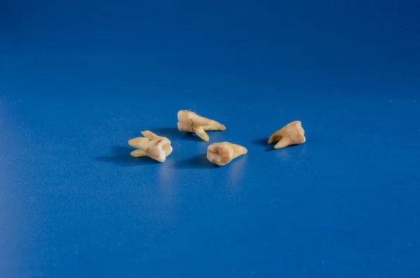 Четыре рваных человеческих зуба на синем фоне . — стоковое фото