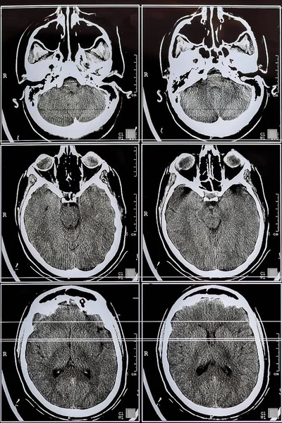 MRI scan of the brain. Magnetic resonance scan of the brain. Medicine, science. Selective focus Magnetic resonance scan of the brain. Medicine, science.