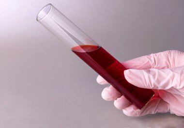 Gri arka planda bir sağlık çalışanının elinde kan testi olan bir test tüpü. Boşluğu kopyala.
