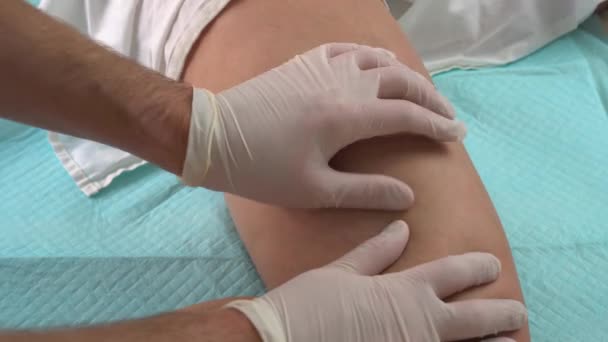 Hände eines Arztes in weißen Latex-Handschuhen während der Untersuchung des Beines mit Krampfadern — Stockvideo