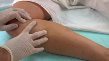 Doktor varis için skleroterapiden önce hastaları muayene eder.