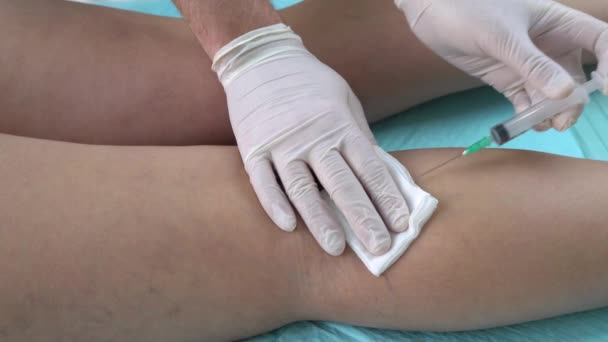 Escleroterapia. médicos manos con jeringa durante el tratamiento de las venas varicosas — Vídeo de stock