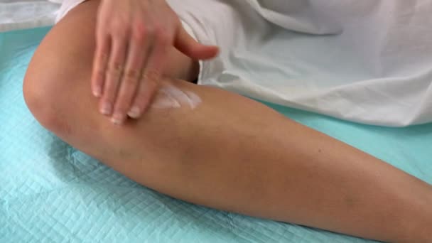 Η γυναίκα πασαλείβει το πόδι της με κρέμα. Κρέμα για πόδια με κιρσούς — Αρχείο Βίντεο