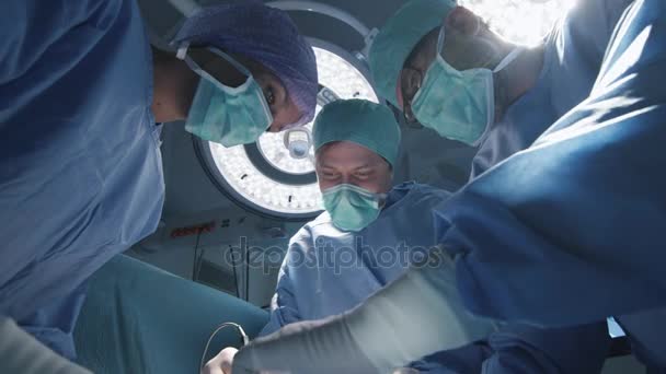 Η ομάδα των γιατρών και νοσηλευτών εκτελούν χειρουργική επέμβαση. Ασθενή άποψη. — Αρχείο Βίντεο