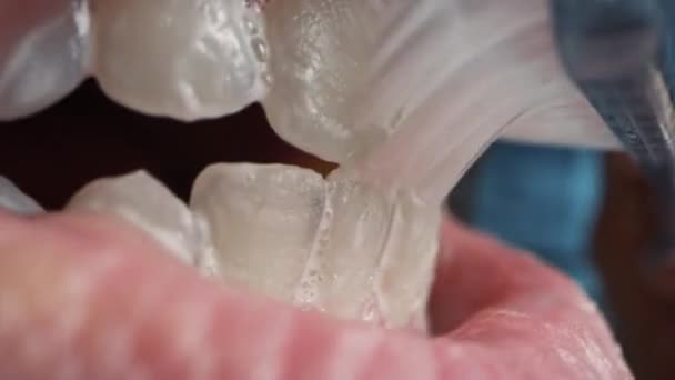 Extreme close-up Macro Shot van een persoon borstelen witte tanden. Whitening Tandpasta wordt gebruikt op een handmatige tandenborstel die horizontaal en cirkelvormig wordt verplaatst. Natuurlijke mond met perfecte witte tanden. — Stockvideo