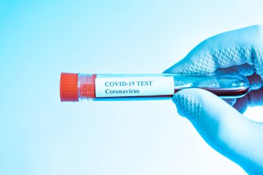 Coronavirus testi laboratuvarda yapıldı. Covid 19. Laboratuvarda test örneğiyle birlikte test tüpü tutan plastik eldivenli kol. El işi. Mavi ton filtresi.