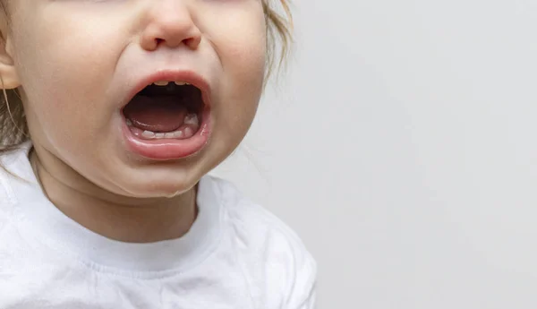 Portrait of a baby toddler child crying. Kid opened his mouth wide, in which fangs erupt and saliva flows. The child has toothaches and a crisis of 1 year of life. Copy space text, banner, close-up — Stock Photo, Image