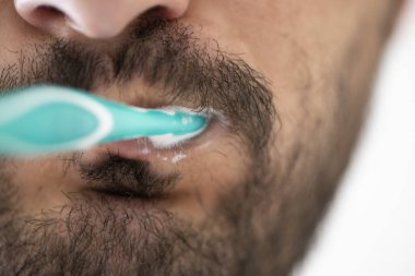 Çürük dişler yakın plan. Dişte kahverengi noktalar var..