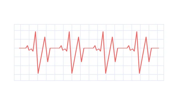 Medicine chart, heart rhythms in flat style — Stock Vector