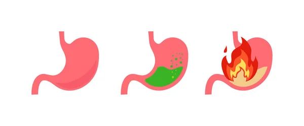 Stomach Set Vector Medicine Isolated Flat Illustration — Stock Vector