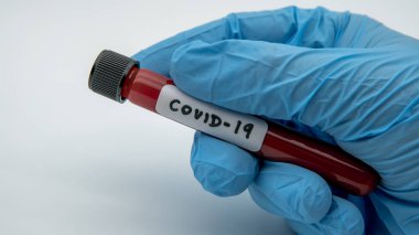 COVID-19 'un iyileşmesine yardımcı olmak için sağlık hizmeti. Koronavirüsü pozitif olan ameliyat eldivenleri kan örneğini etkiledi. Bilim adamı doktorun eli biyolojik tehlike koruma giysisi