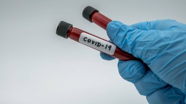 Laboratuvar teknisyenleri Corona virüsü testi için kan örneği tüpünü tutuyorlar. COVID-19. Koruma için mavi eldivenli bilim adamı. 2019-NCoV için aşı araştırması