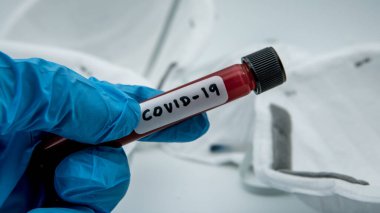 Koruyucu maske ve pozitif COVID-19 testi. Yeni Corona virüsü enfeksiyonu teşhisi için laboratuvar kan testi. Wuhan 'dan 2019 numaralı hastalık. Bulaşıcı salgın konsepti