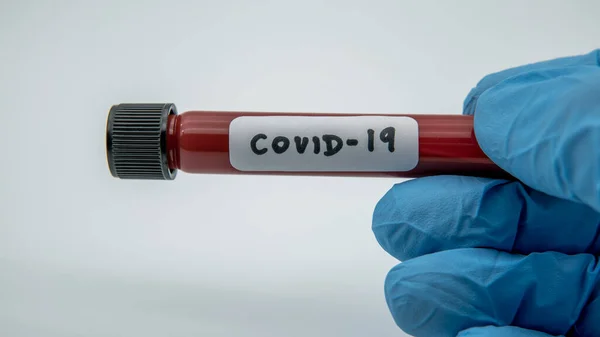 Tubul Testare Probă Sânge Infectată Pentru Covid Coronavirus Nou Găsit — Fotografie, imagine de stoc