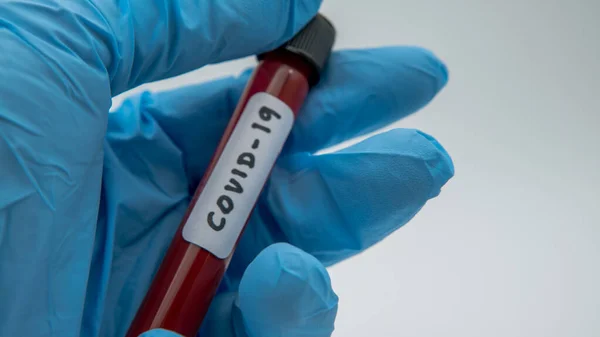 Reagenzglas Mit Infizierter Blutprobe Für Covid Neuartiges Coronavirus Das Wuhan — Stockfoto