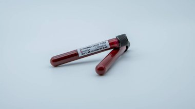 COVID-19 için enfekte kan örneği içeren test tüpü. Wuhan, Çin 'de bulunan yeni bir koronavirüs. 2019-NCoV virüsü için aşı araştırması. Bulaşıcı hastalıklara karşı konsept
